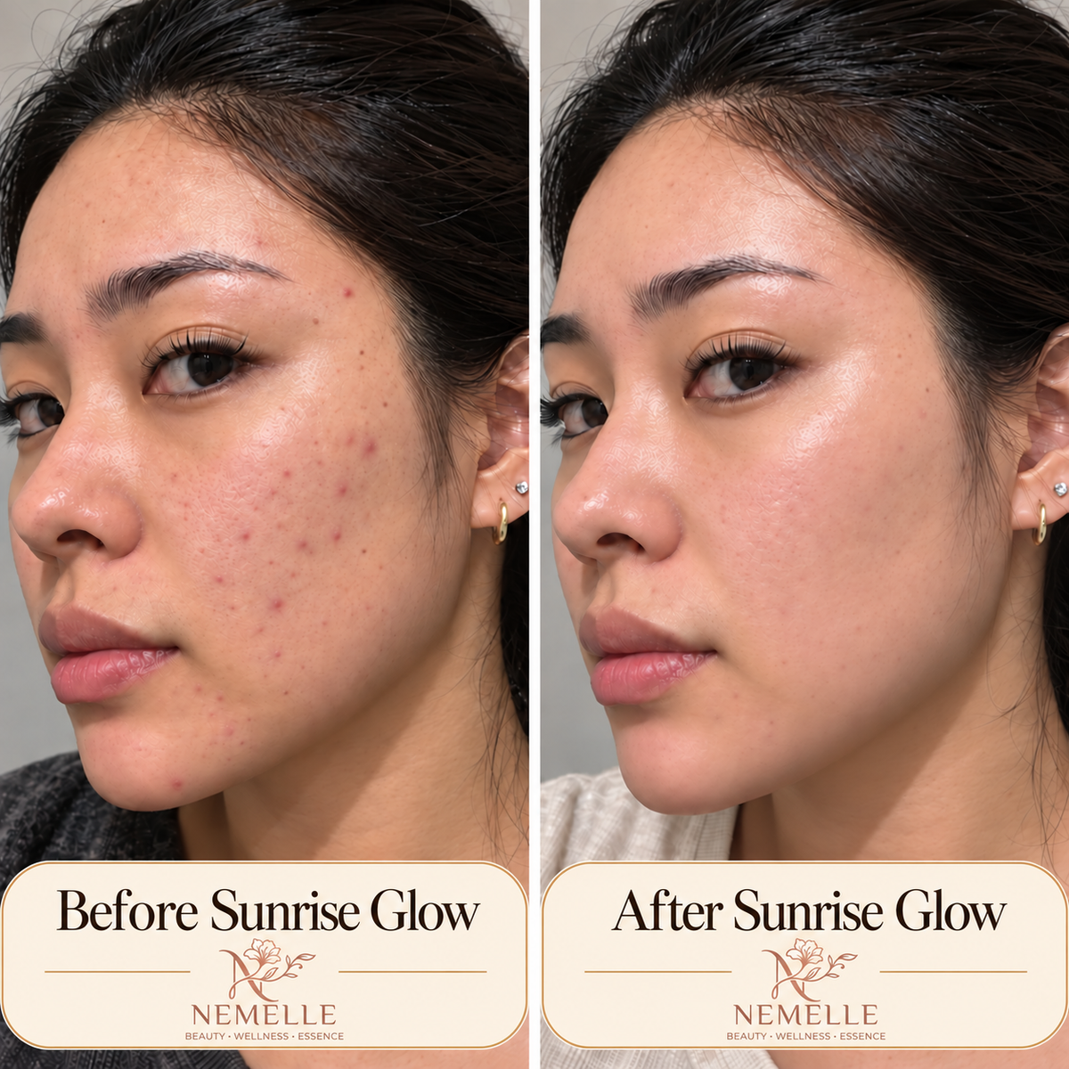Sunrise Glow, before and after. Results may vary.